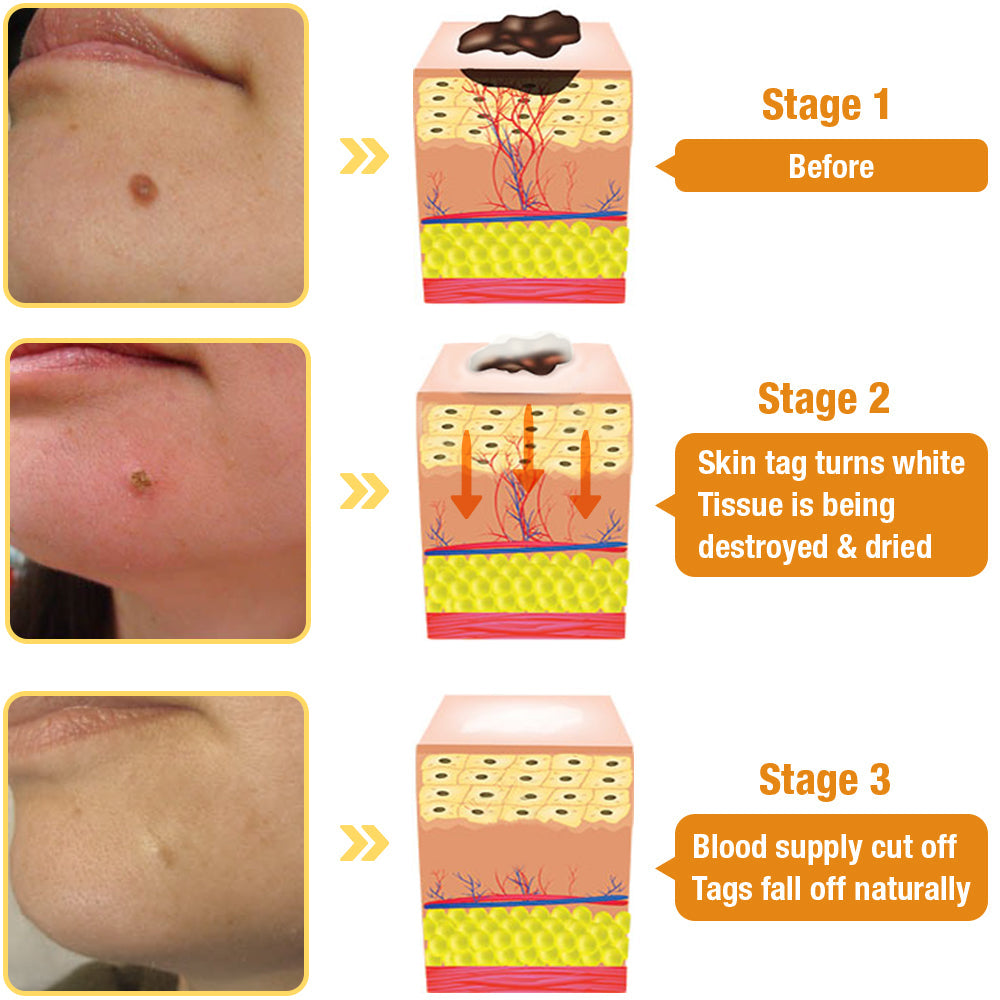 โจ๐๐๐ฌ๐ญ ๐๐๐ฒ ๐๐ข๐ฌ๐๐จ๐ฎ๐ง๐ญ: 87% ๐๐
๐
๐AQAโข Tag Recede Bees Treatment Spray