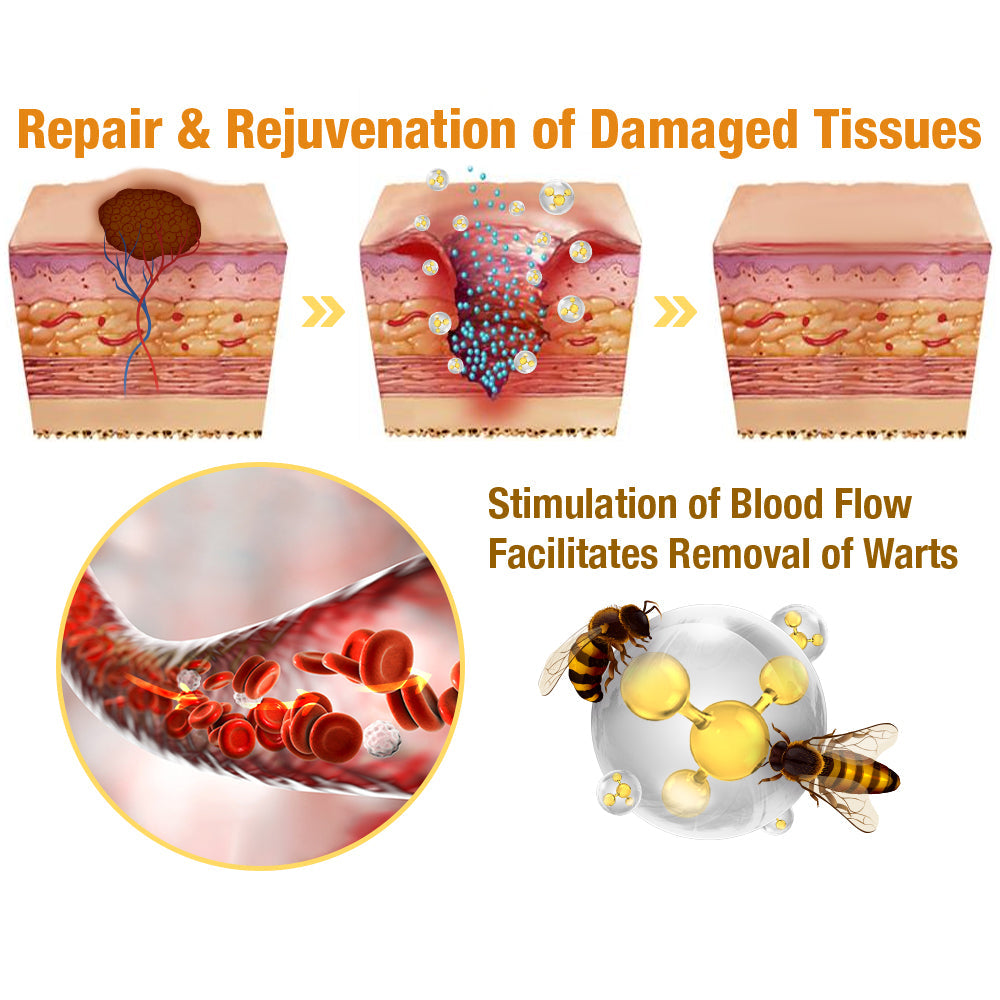 โจ๐๐๐ฌ๐ญ ๐๐๐ฒ ๐๐ข๐ฌ๐๐จ๐ฎ๐ง๐ญ: 87% ๐๐
๐
๐AQAโข Tag Recede Bees Treatment Spray