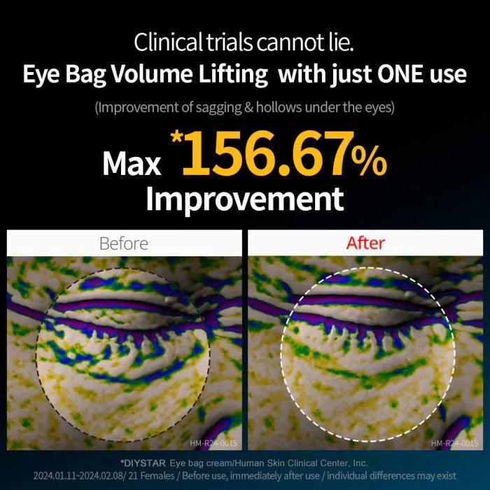 ⭐Ultimate Under‑Eye Lift & Brighten Cream – Eyebag Erase