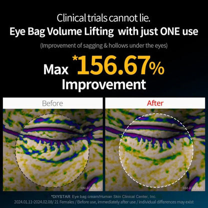 ⭐Ultimate Under‑Eye Lift & Brighten Cream – Eyebag Erase