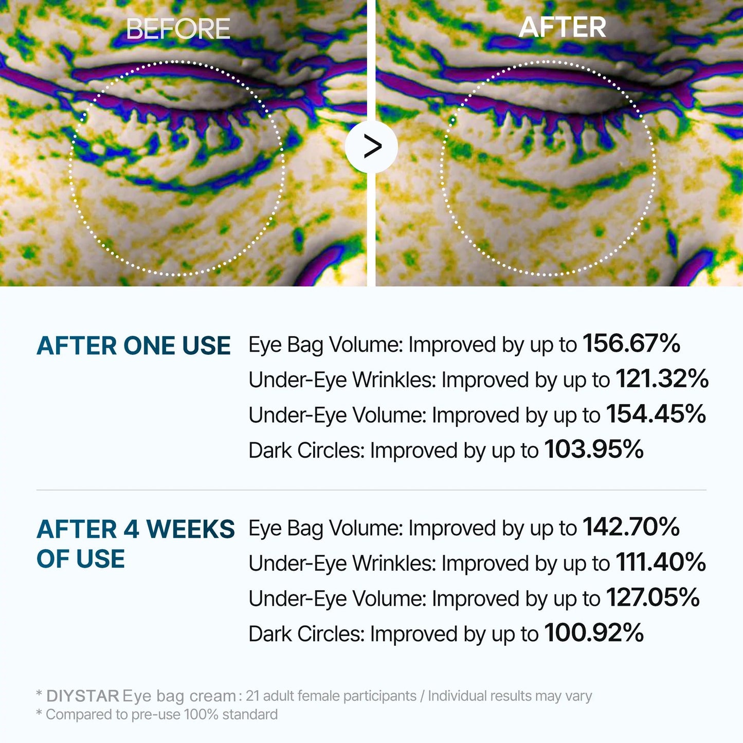 ⭐Ultimate Under‑Eye Lift & Brighten Cream – Eyebag Erase