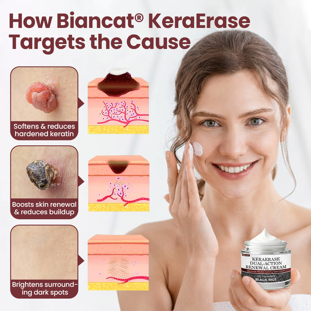 BBOJI®KeraErase Dual-Action Renewal Cream