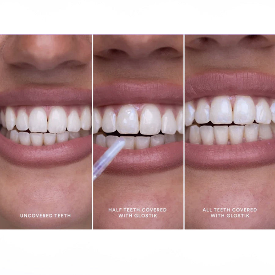 Clinclii™ Instant Glow Tooth Gloss–Your Smile’s Finishing Touch ✨