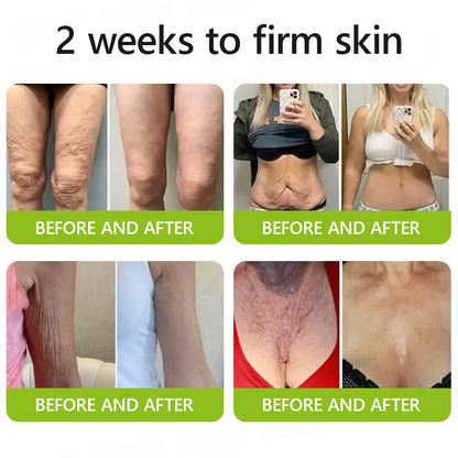 𝑶𝒇𝒇𝒊𝒄𝒊𝒂𝒍 𝑺𝒕𝒐𝒓𝒆👍| Regain youthful skin nown 💫LOVILDS® BOTOX & VITA A RETINOL SHOT Wrinkle Lift Tightening Cream