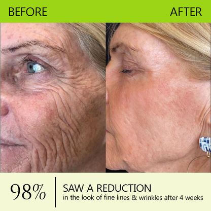 𝑶𝒇𝒇𝒊𝒄𝒊𝒂𝒍 𝑺𝒕𝒐𝒓𝒆👍| Regain youthful skin nown 💫LOVILDS® BOTOX & VITA A RETINOL SHOT Wrinkle Lift Tightening Cream