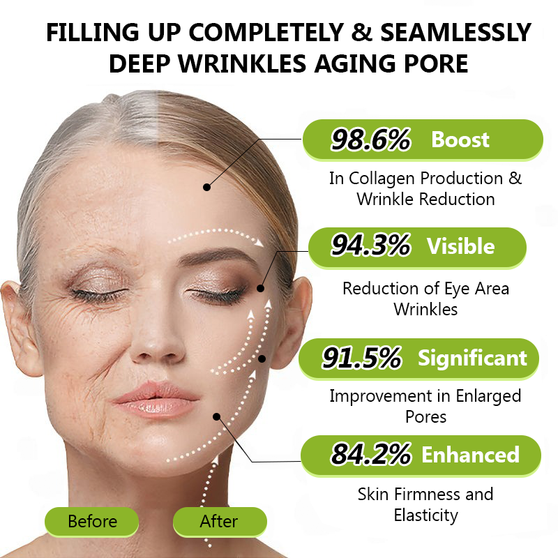 𝑶𝒇𝒇𝒊𝒄𝒊𝒂𝒍 𝑺𝒕𝒐𝒓𝒆👍| Regain youthful skin nown 💫LOVILDS® BOTOX & VITA A RETINOL SHOT Wrinkle Lift Tightening Cream