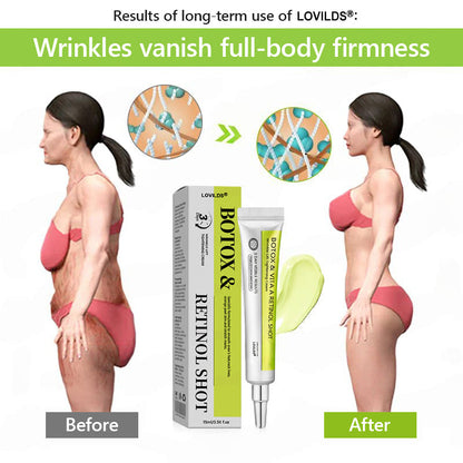 𝑶𝒇𝒇𝒊𝒄𝒊𝒂𝒍 𝑺𝒕𝒐𝒓𝒆👍| Regain youthful skin nown 💫LOVILDS® BOTOX & VITA A RETINOL SHOT Wrinkle Lift Tightening Cream