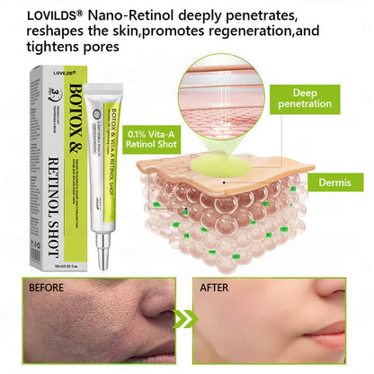𝑶𝒇𝒇𝒊𝒄𝒊𝒂𝒍 𝑺𝒕𝒐𝒓𝒆👍| Regain youthful skin nown 💫LOVILDS® BOTOX & VITA A RETINOL SHOT Wrinkle Lift Tightening Cream
