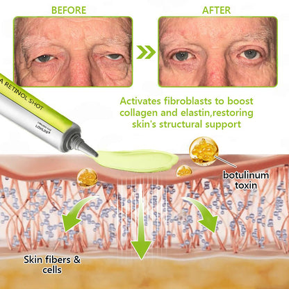 𝑶𝒇𝒇𝒊𝒄𝒊𝒂𝒍 𝑺𝒕𝒐𝒓𝒆👍| Regain youthful skin nown 💫LOVILDS® BOTOX & VITA A RETINOL SHOT Wrinkle Lift Tightening Cream